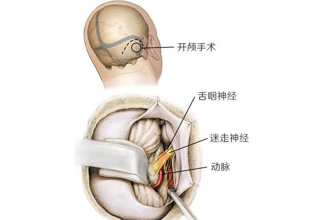 嗓子疼的原因有哪些