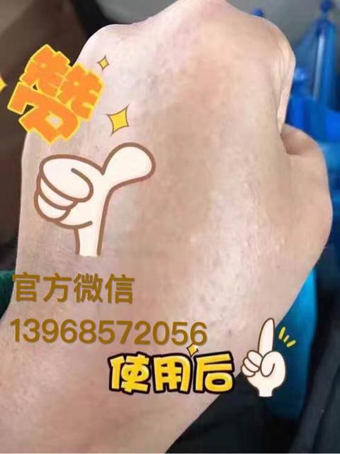 秋冬季小孩为什么容易过敏