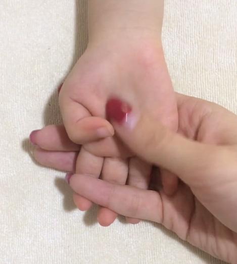 4个月宝宝咳嗽推拿手法图解