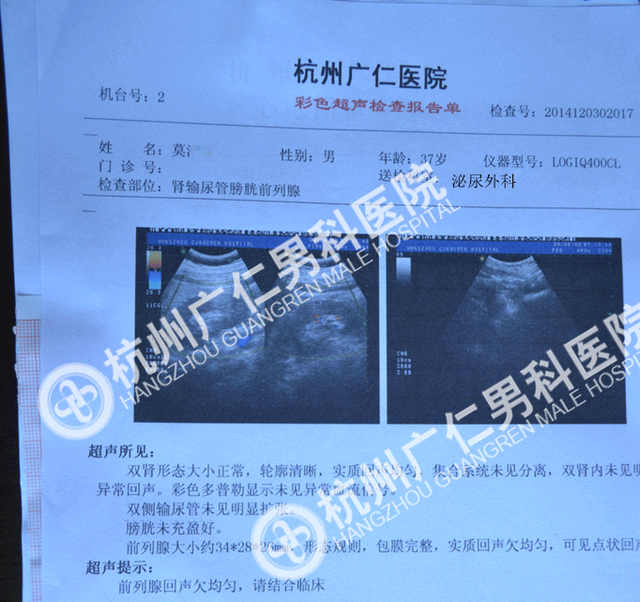 男性慢性前列腺炎的症状有哪些