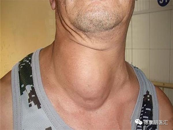 怎么知道孩子是不是阴虚