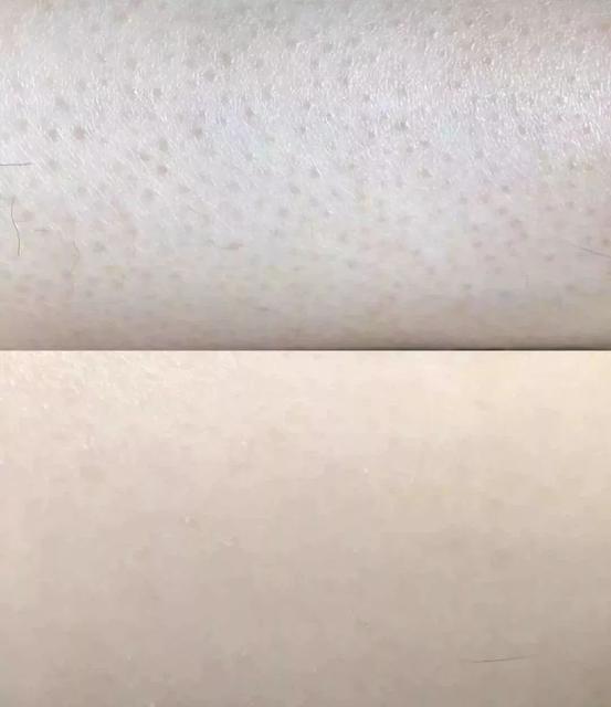 秋天皮肤容易发干吗