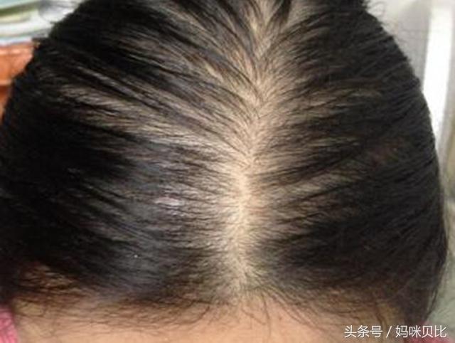 宝宝剃光头能让头发茂密吗