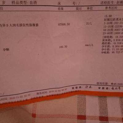 怀孕后hCG的数据变化怎么看