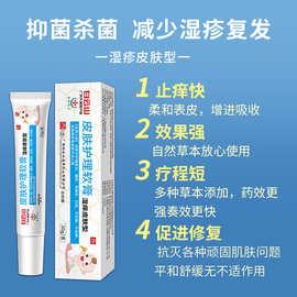 小儿荨麻疹如何护理