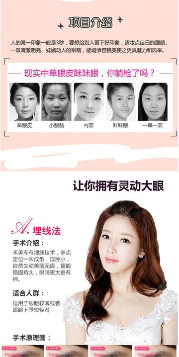 埋线双眼皮长沙相关长尾关键词有哪些