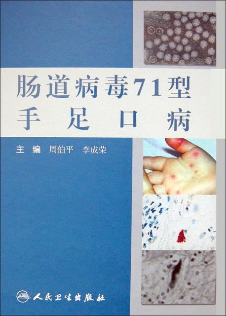 新生儿肠病毒有哪些症状