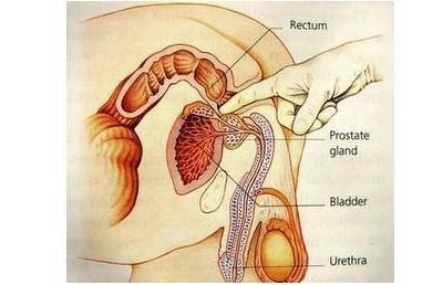 怎么判断乳头内陷程度