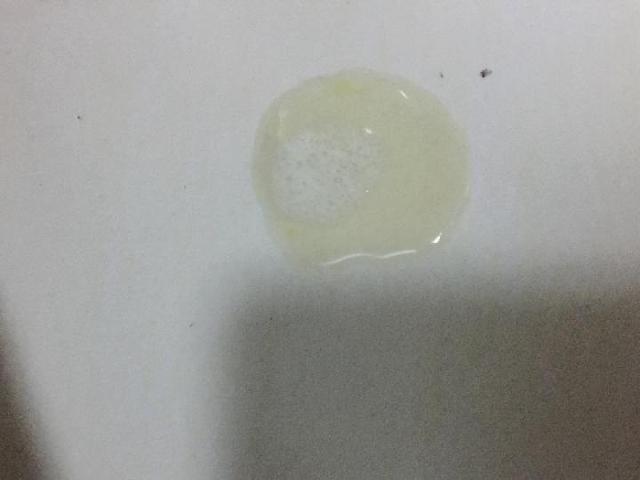 治疗宝宝咳嗽有痰的药