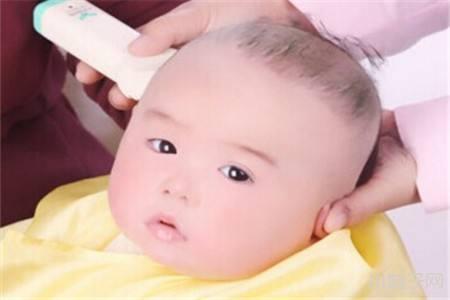 宝宝头上长痱子需要剃光头吗