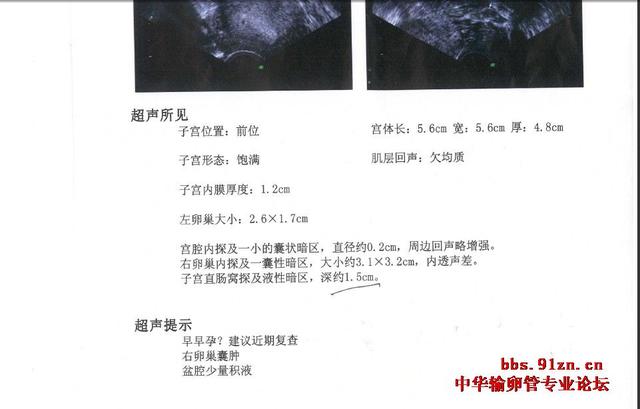 X光输卵管造影