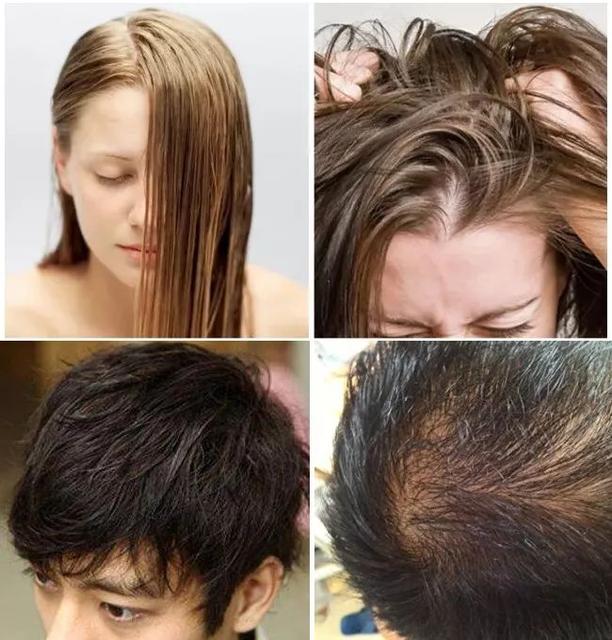怎么样才能让宝宝拥有一头好头发