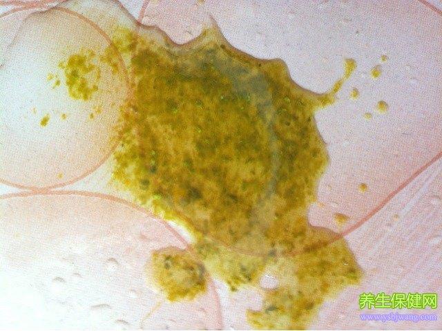 吃母乳的宝宝腹泻怎么办