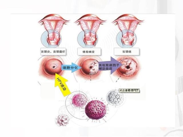 请问子宫切除了还能过性生活吗