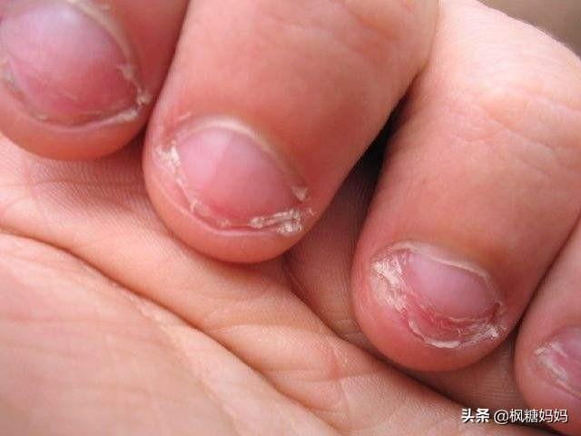 宝宝啃指甲是怎么回事