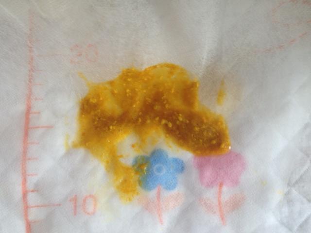 奶粉宝宝大便怎样是正常的