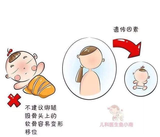 宝宝臀纹不对称是怎么回事