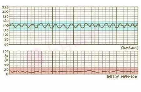 孕晚期的胎心率多少正常