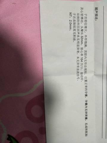 孕期正常的胎心率是多少