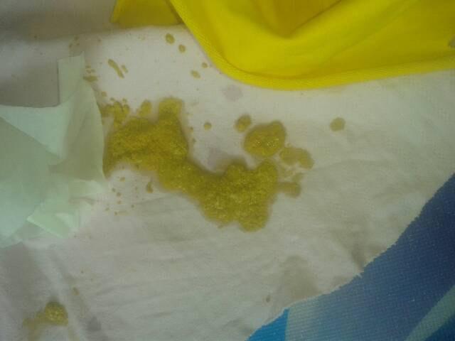 宝宝拉大便多久算一次