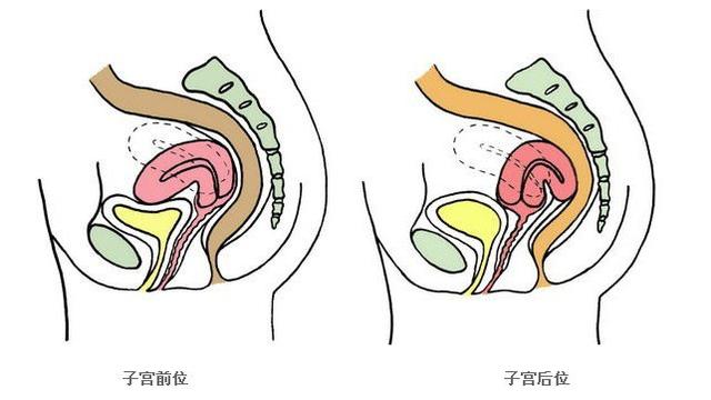子宫后位受孕难吗