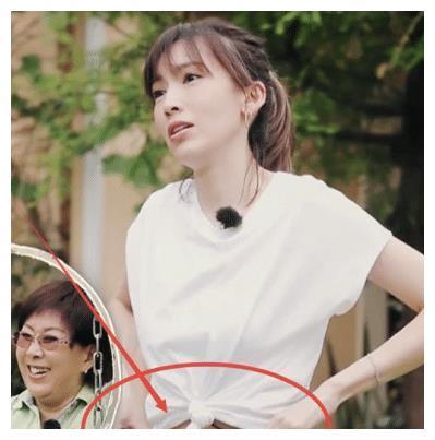 怀双胞胎容易长妊娠纹吗