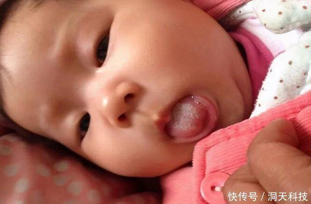 一岁宝宝腹胀怎么办