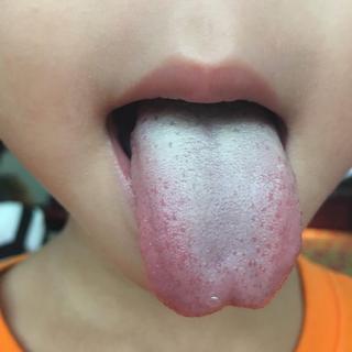 脾虚的孩子怎么调理