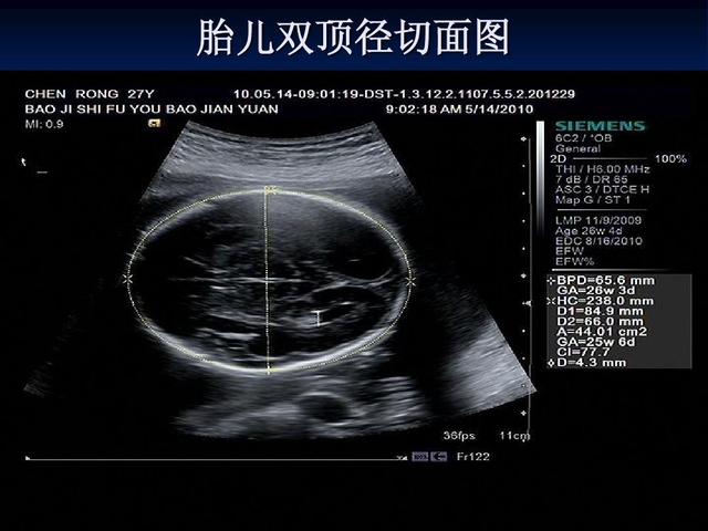 产科超声检查分几级