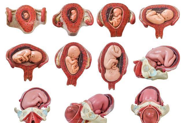 睡姿会影响胎儿胎位吗