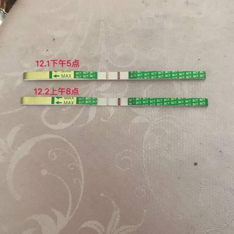 新生儿出现假性月经怎么回事