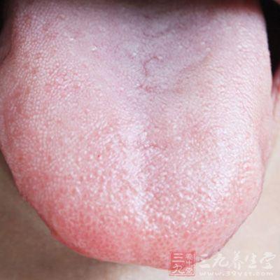 孩子体内湿气重怎么办
