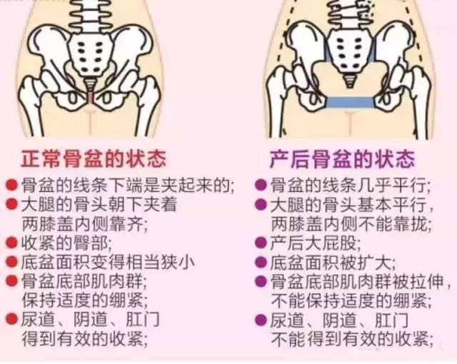 孕妇耻骨痛是一种什么感觉