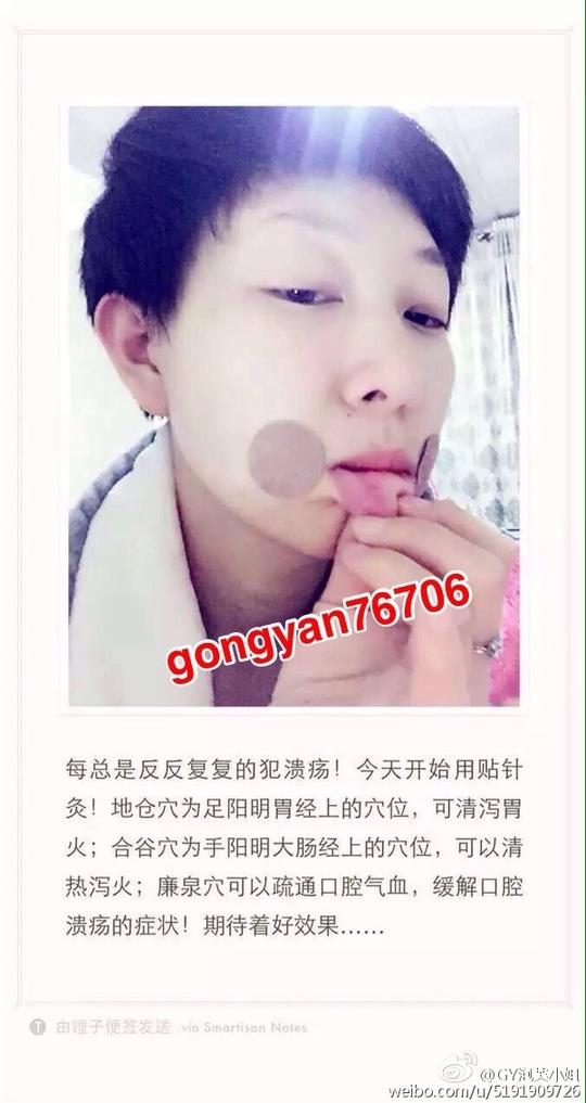 贴针灸丰胸微达人的相册详情微女郎,微博美女创业,微博美女,美女