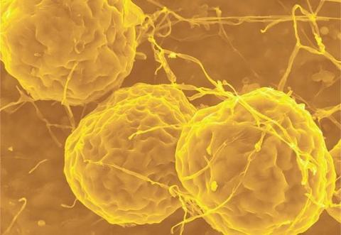 显微镜下的金花