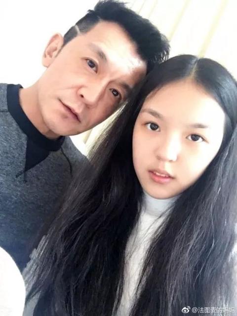 乳涨的预防以及治疗措施