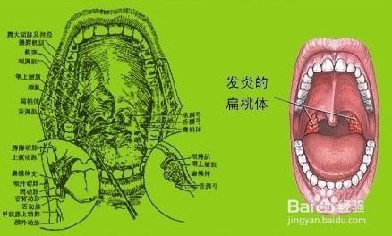 孩子为什么总是扁桃体发炎发烧