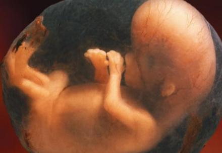 孕期正确的姿势有助安胎