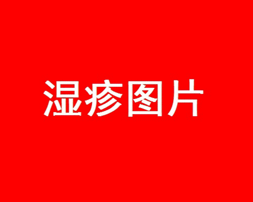 孩子长痱子怎么处理