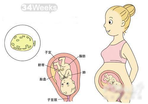 怀孕时候肾积水会不会有后遗症