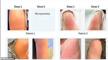 吃替拉依能打新冠疫苗吗 吃替拉依会感染新冠吗