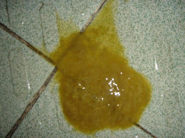 婴儿腹泻怎么办什么方法最有效