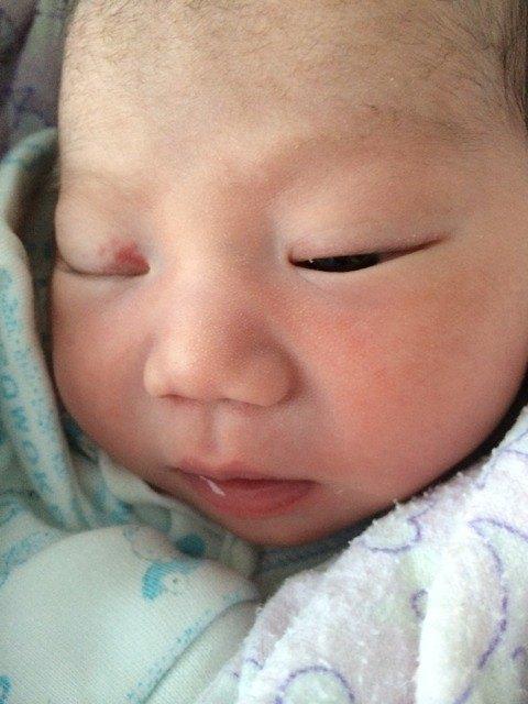 宝宝身上有红印子是怎么回事