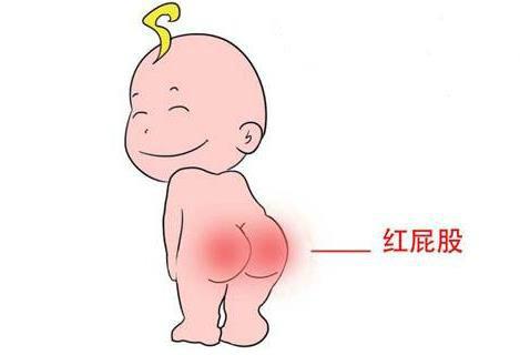 宝宝为什么会红屁股?