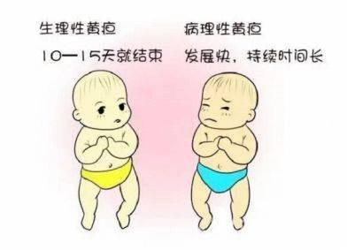 新生儿黄疸是什么原因引起的