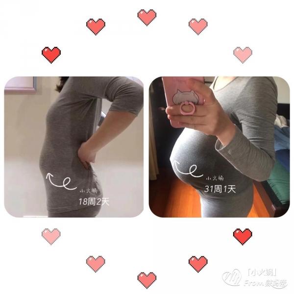 孕妇怀男孩有什么症状