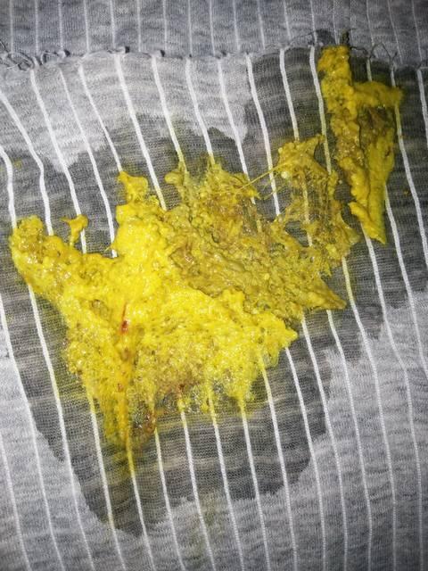 宝宝对牛奶蛋白过敏怎么办,多大会好