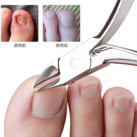 新生儿多久就可以剪指甲