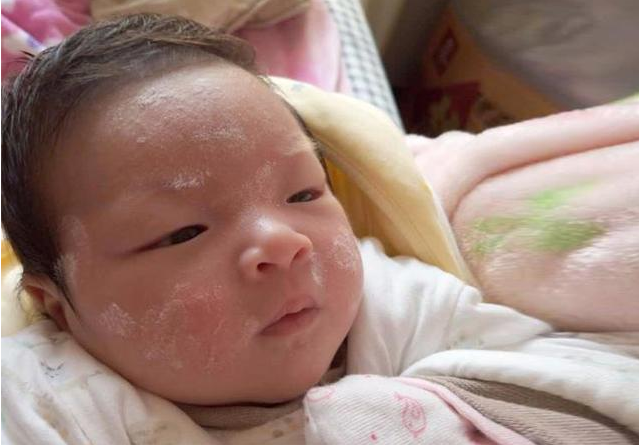春季如何护理宝宝