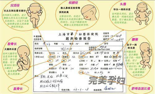 孕38周胎动频繁是不是要生了